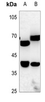 ZNF187 Antibody