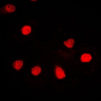 ZNF187 Antibody