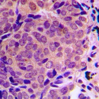 Anti-ALMS1 Antibody