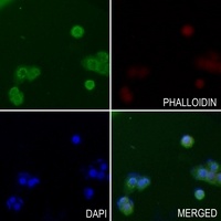 Anti-ALMS1 Antibody
