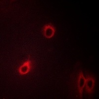 CXCR4 (phospho-S339) antibody