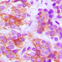 Anti-Frizzled 5 Antibody