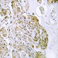 Anti-TFEB Antibody