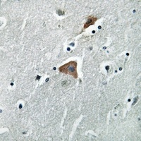 Anti-mTERF Antibody