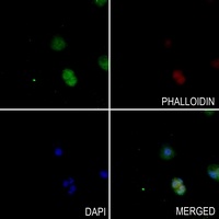 Anti-mTERF Antibody