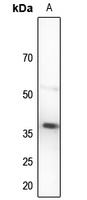 TUSC3 Antibody