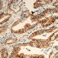 Anti-TUSC3 Antibody