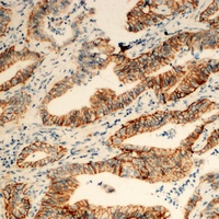 TUSC3 antibody