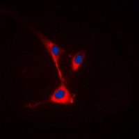 Anti-TUSC3 Antibody