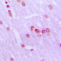 Anti-BRD3 Antibody