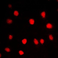 Anti-BRD3 Antibody