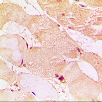 Anti-Dysferlin Antibody