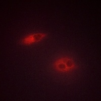 Anti-Dysferlin Antibody