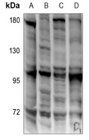EOMES Rabbit Polyclonal Antibody