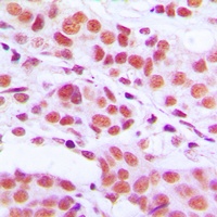 Anti-Histone H3 (Phospho-S10) Antibody