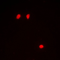 Anti-Histone H3 (Phospho-S10) Antibody