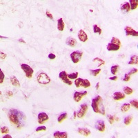 Cullin 1 Antibody [KO/KD Validated]