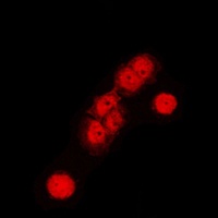Cullin 1 Antibody [KO/KD Validated]