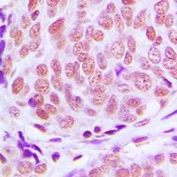 Anti-KLF11 Antibody