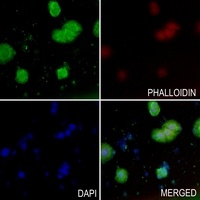 Anti-MRCK alpha Antibody