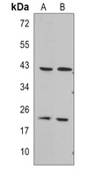 RGS5 Antibody
