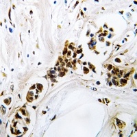 Anti-RGS5 Antibody