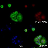 Anti-RGS5 Antibody