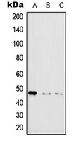 IKK gamma (Phospho-S31) Antibody
