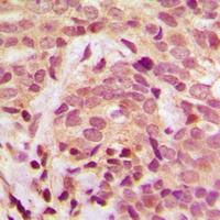 IKK gamma (Phospho-S31) Antibody
