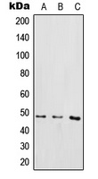 IKK gamma (Phospho-S85) Antibody