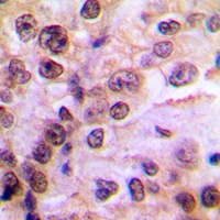 IKK gamma (Phospho-S85) Antibody