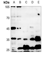 IKK gamma Antibody