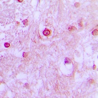 Anti-CDK10 Antibody