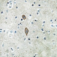 Anti-MADD Antibody
