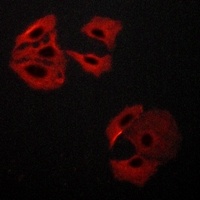 Anti-MADD Antibody