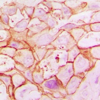 Anti-ARALAR1 Antibody