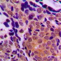 Anti-p63 Antibody