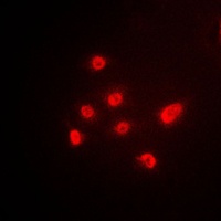 Anti-p63 Antibody