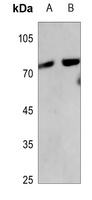 p63 Rabbit Polyclonal Antibody