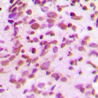 Anti-RPC Antibody
