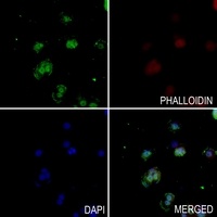 Anti-RPC Antibody