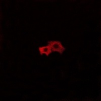 Anti-EDG6 Antibody