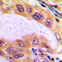 Anti-B4GALT3 Antibody