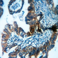 Anti-MRP3 Antibody