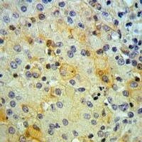 Anti-SNX4 Antibody