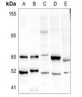 URI1 Antibody