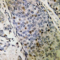 URI1 antibody