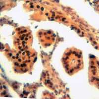 Anti-RAIDD Antibody
