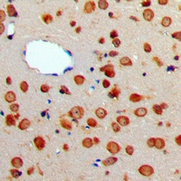 Anti-CD256 Antibody