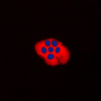 Anti-CD256 Antibody
